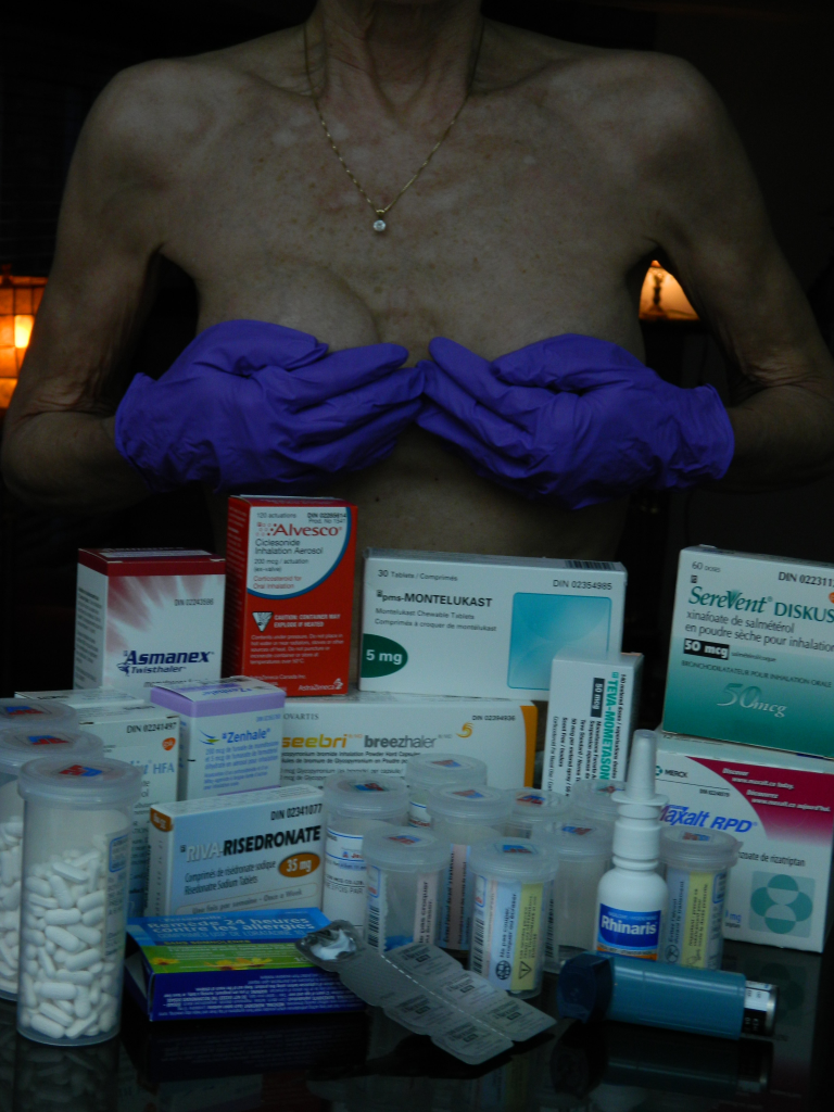 Explantation mammaire: que faut-il savoir ? implants