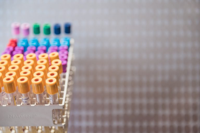 Une prise de sang sans attente